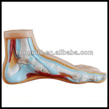 ISO Normal, flach und gewölbtes Fußmodell, Anatomisches Modell